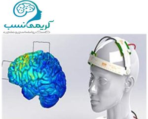 درمان حملات پنیک با تحریک مغزی و tdcs