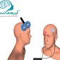 درمان حملات پنیک با تحریک مغزی و tdcs