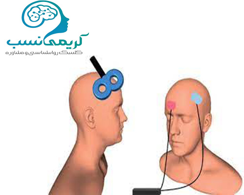 درمان حملات پنیک با تحریک مغزی و tdcs